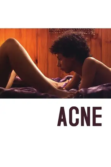 Acné veroTV Online • Pelicula Completa