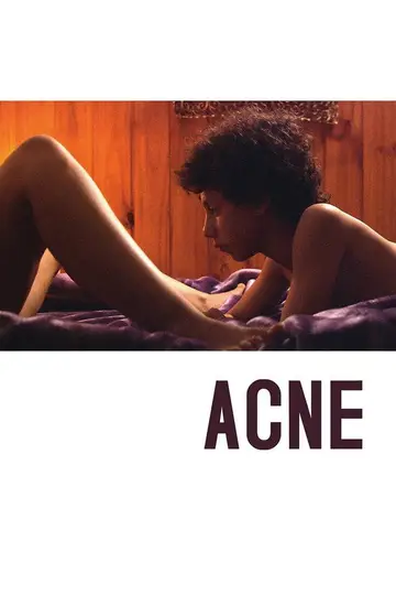 Acné